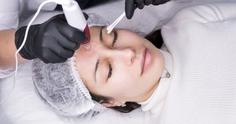 What Is Micro-Needling?